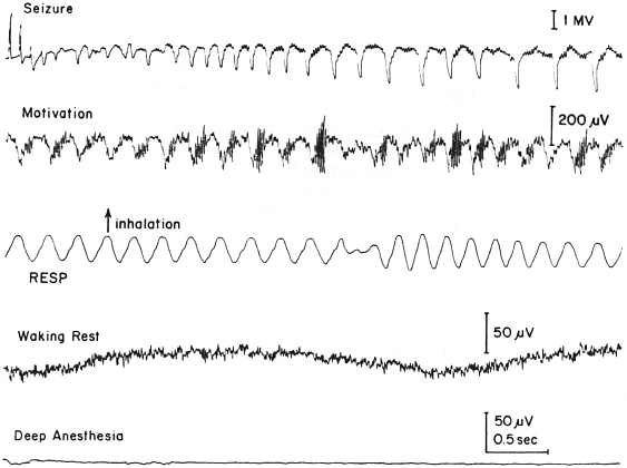 Eeg Rhythms